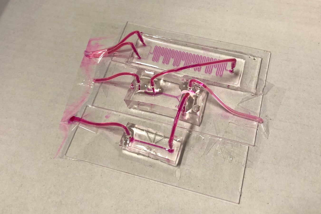 New monitoring technology could help identify more donor lungs for transplantation