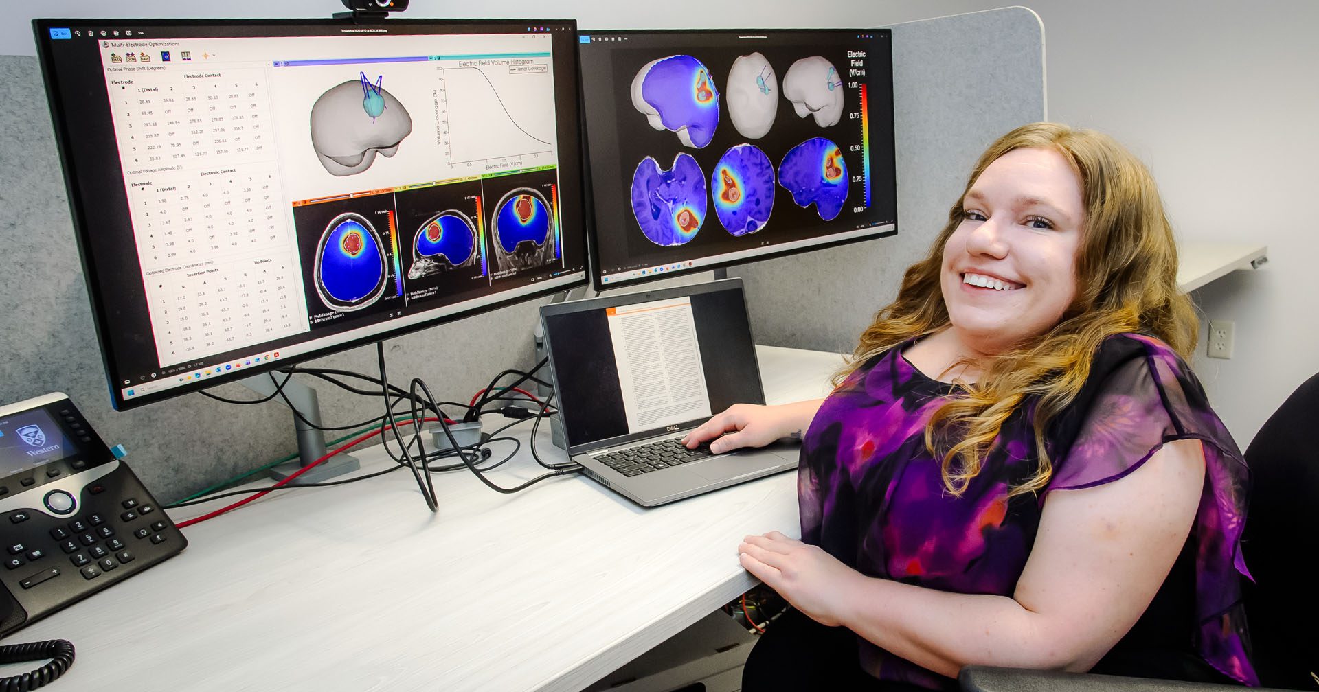 Electric fields offer new hope against aggressive brain cancer. Official Western News image.